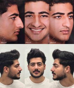 دکتر امید زرگرانی نمونه کار