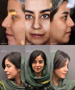 دکتر امید زرگرانی نمونه کار