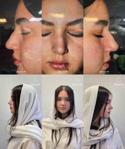 دکتر امید زرگرانی نمونه کار