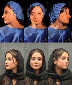دکتر امید زرگرانی نمونه کار