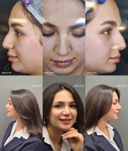 دکتر امید زرگرانی نمونه کار
