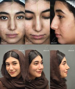 دکتر امید زرگرانی نمونه کار