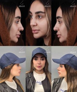 دکتر امید زرگرانی نمونه کار