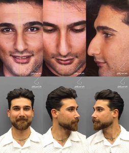 دکتر امید زرگرانی نمونه کار