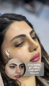 دکتر حامد پوستچی نمونه کار
